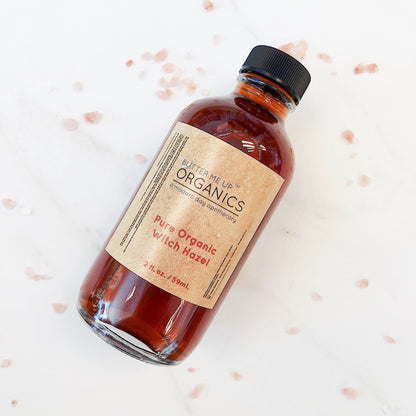 Organic Witch Hazel / Organic Facial Toner / Blemishes / Acne